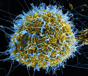 Ebola Virus Particles from flickr